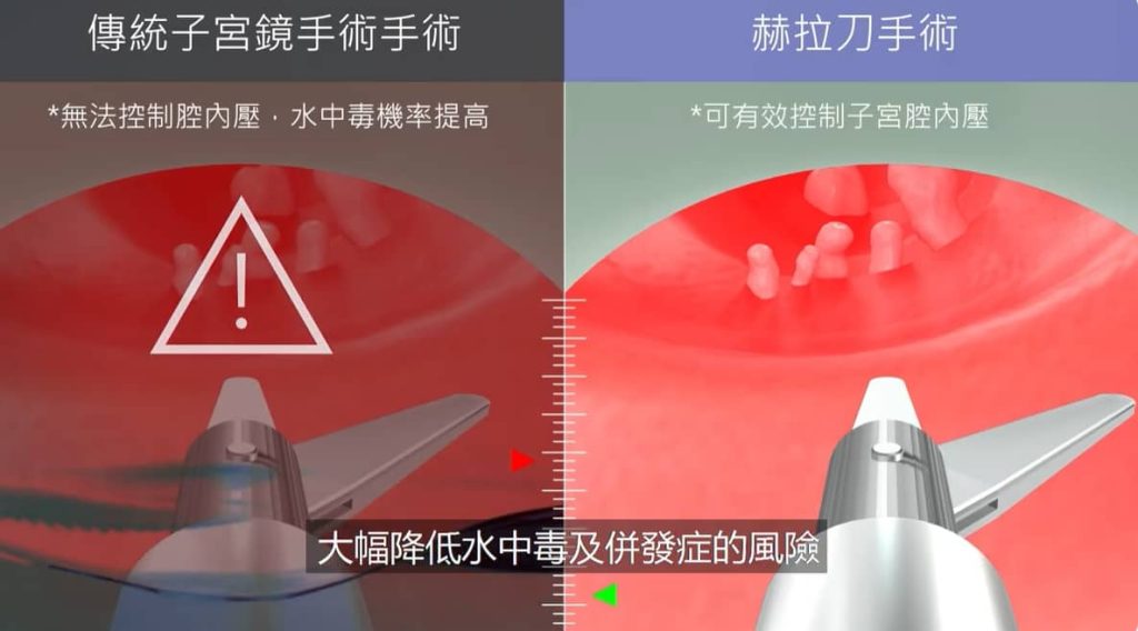 傳統子宮鏡 & 赫拉刀子宮腔內壓控制 差異比較